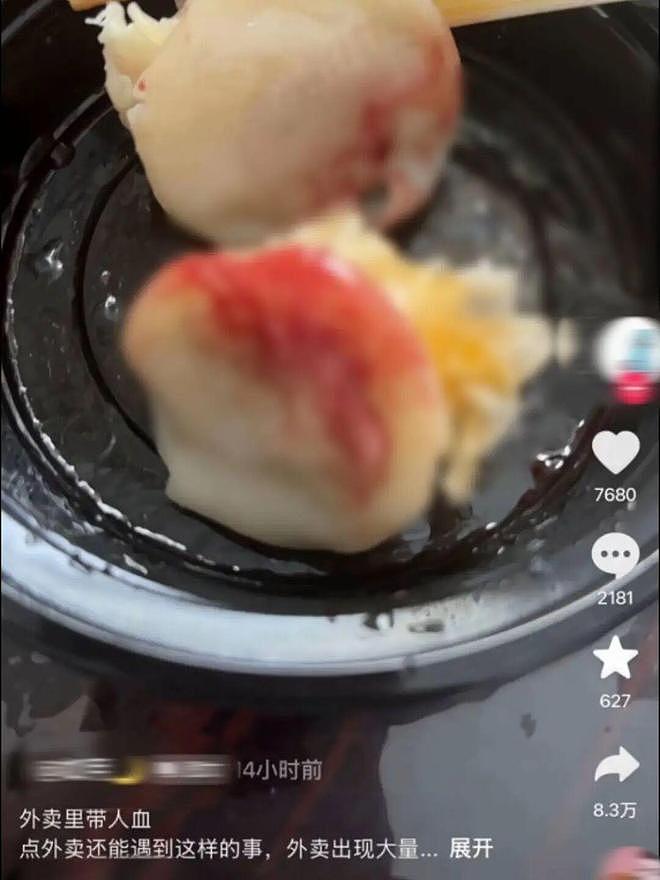 杭州一网友吃到带鲜血的外卖!报警后紧急就医并服用阻断药!市监部门:店员手受伤流血 - 1