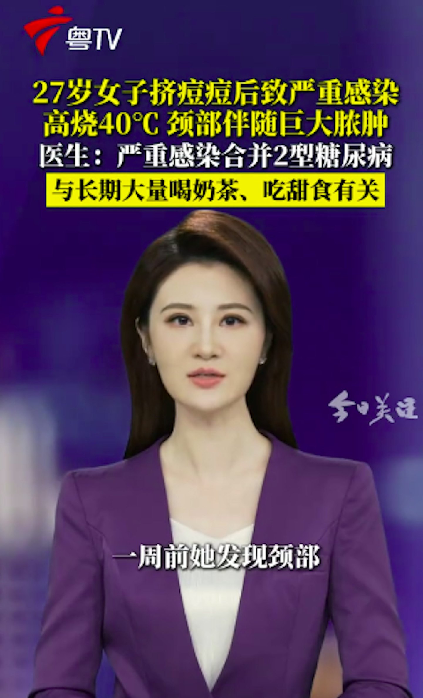 深圳女子日饮四杯奶茶,血液变乳白色!送ICU换血三次才保命(组图) - 9