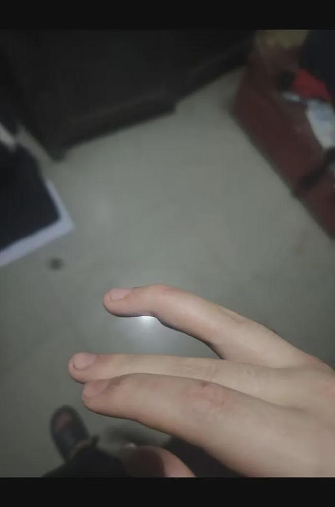23岁双胞胎被强行拖进戒网瘾机构，哥哥自述：遭暴力虐打，被迫吃肥皂（组图） - 3