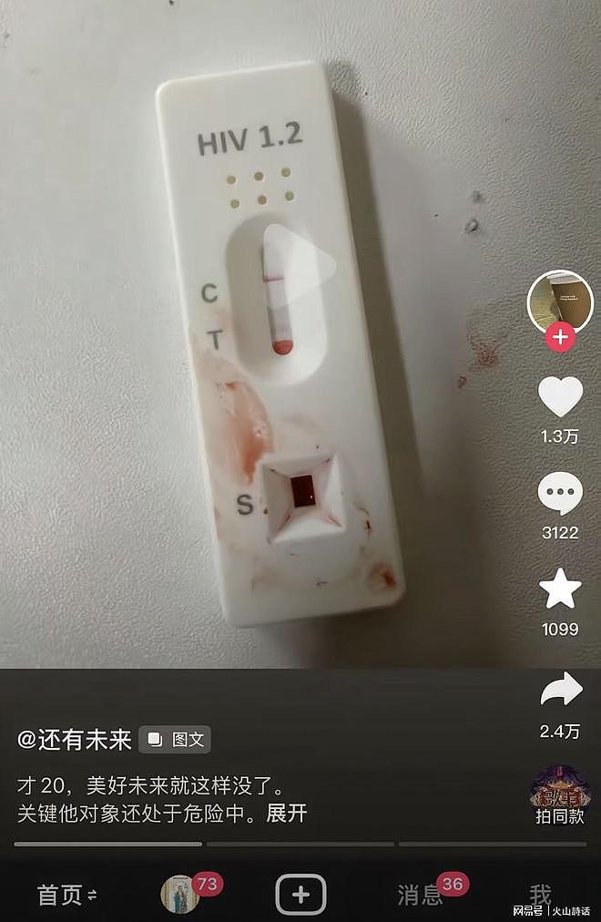 “我中招了,都是在小蓝上乱来的结果”!20岁小伙哭诉撞上HIV - 2