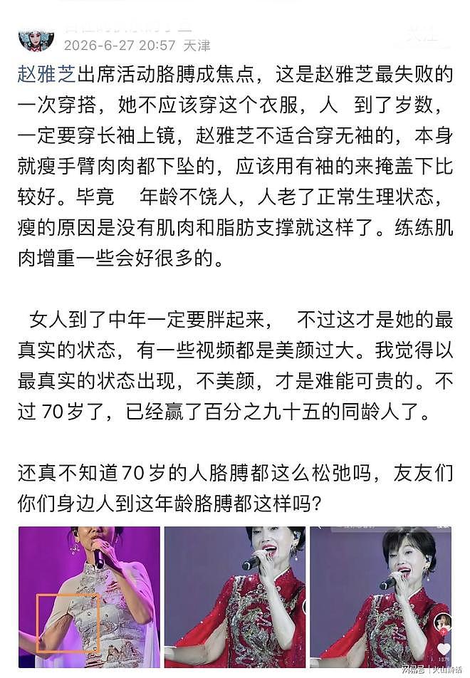 扎心痛啊！70岁赵雅芝舞台无美颜生图曝光，手臂衰老的状态太真实 - 1
