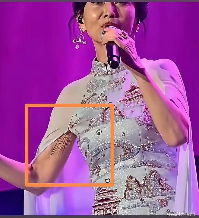 扎心痛啊！70岁赵雅芝舞台无美颜生图曝光，手臂衰老的状态太真实 - 3