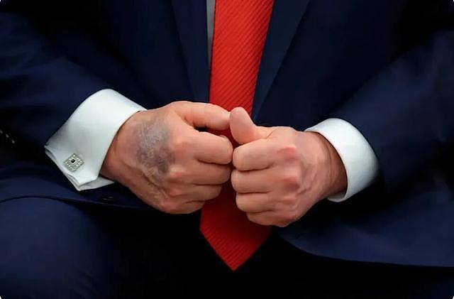 美国众议员暗示特朗普身患绝症，并通过非法手段获得特效药 - 3