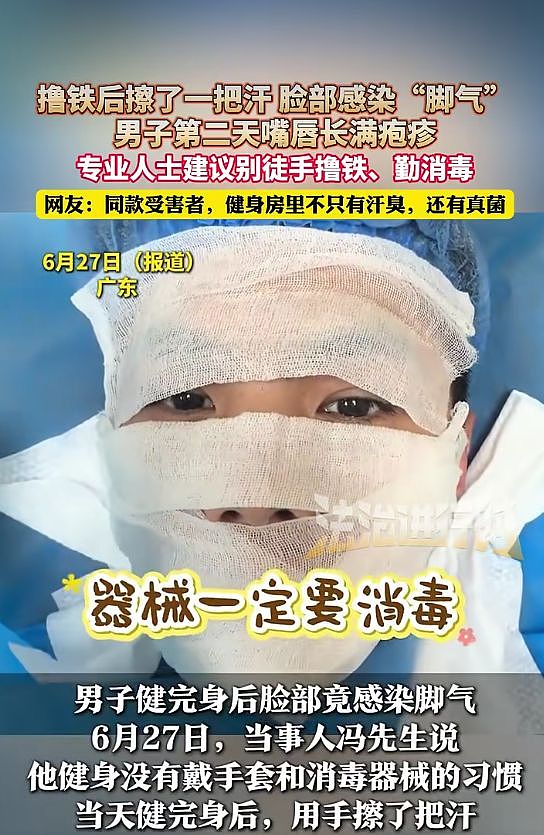 广东男子健身后脸上长“脚气”，直呼太恐怖！网友分享中招经历：屁股长一片痘痘（组图） - 2