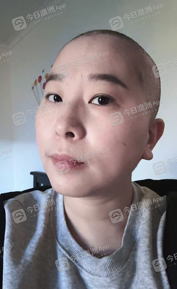 “一枚漂亮的卤蛋！”澳洲华女乳腺癌患者谈身体、尊严与死亡：“愣是活着，哪怕不合逻辑”（组图） - 1
