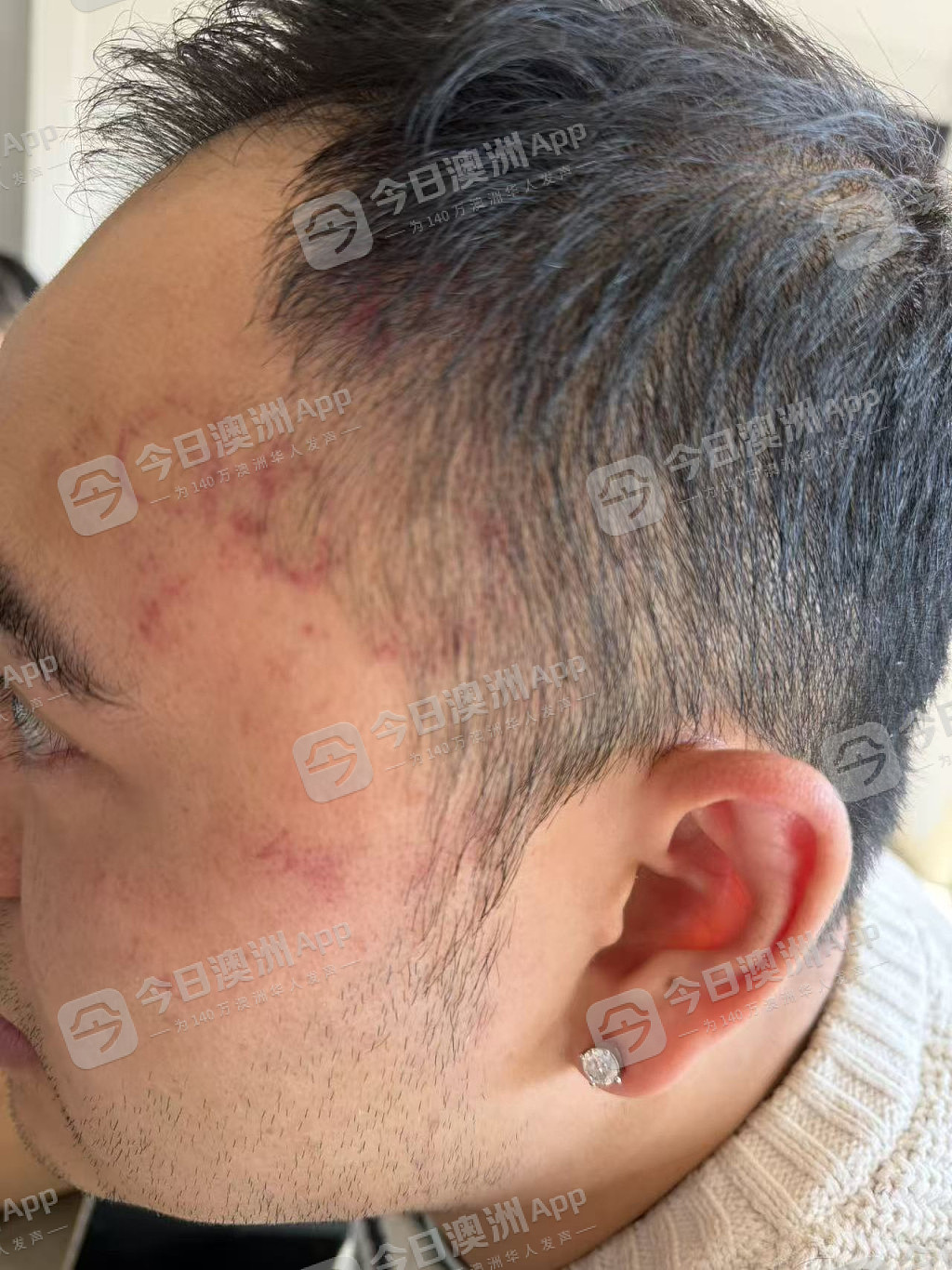 “招招致命!”澳洲华人店主无端遭凶狠围殴,头破血流遍体鳞伤!批警方不作为,华人食客暖心声援(组图) - 4