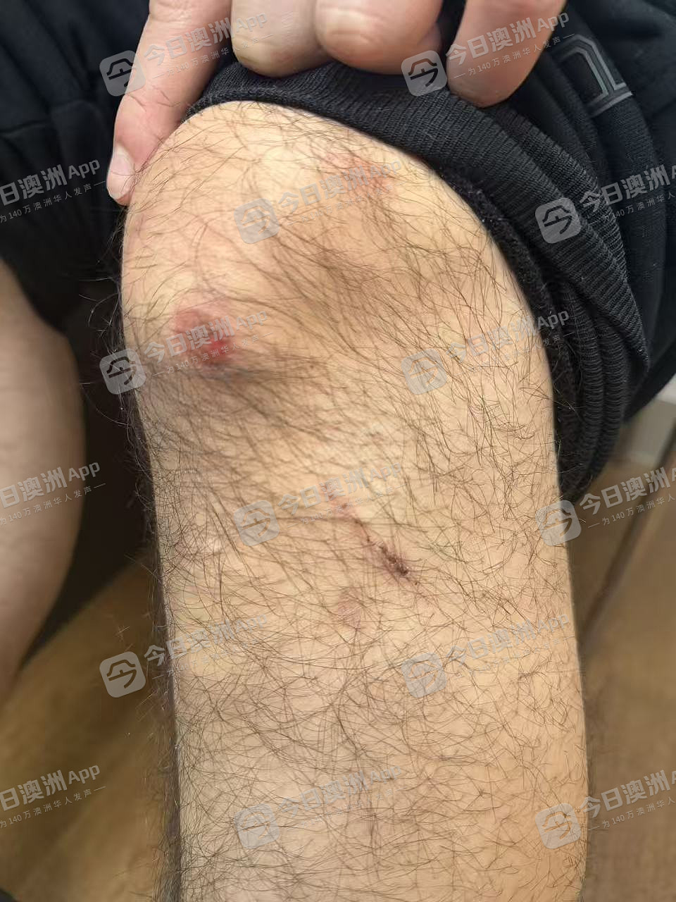“招招致命！”澳洲华人店主无端遭凶狠围殴，头破血流遍体鳞伤！批警方不作为，华人食客暖心声援（组图） - 6