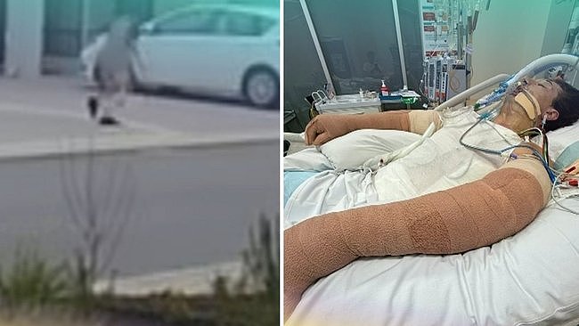 最担心的事发生!扫地机器人突发爆炸,25岁澳男全身75%惨遭烧伤 - 2