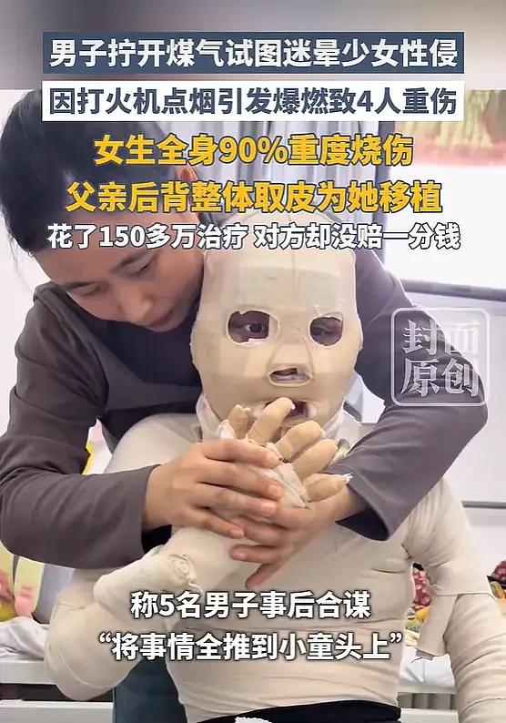 男子拧开煤气试图迷晕少女性侵 ,因点烟引发爆燃 - 1
