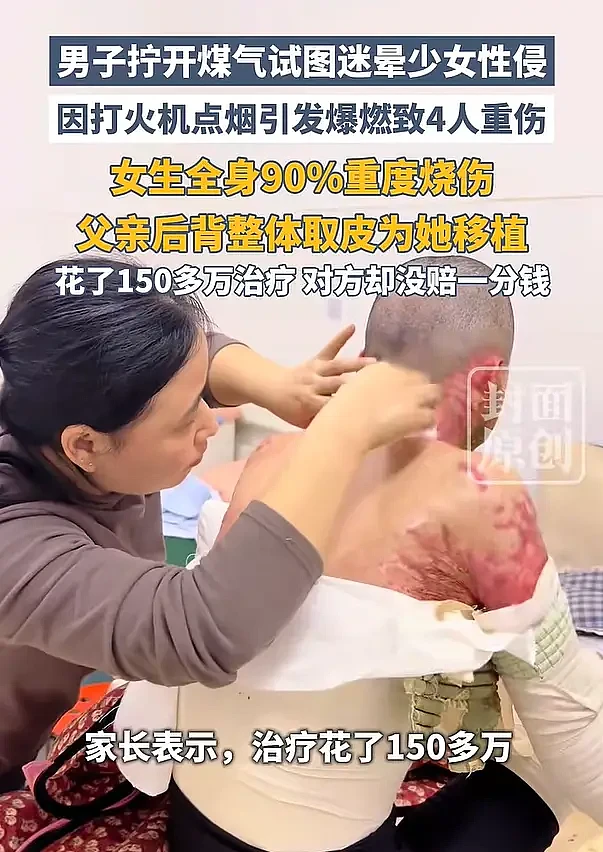 男子拧开煤气试图迷晕少女性侵 ,因点烟引发爆燃 - 3