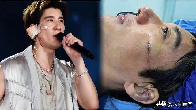 王力宏这次赚大发了,受伤预估值不止10亿,给娱乐圈狠狠上了一课 - 1