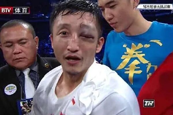 巨星转型下的商海风暴:邹市明夫妇“两亿败局”的商业复盘 - 3