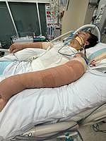 扫地机器人突然爆炸，澳男全身75%烧伤！送医后昏迷数周终苏醒（组图） - 4