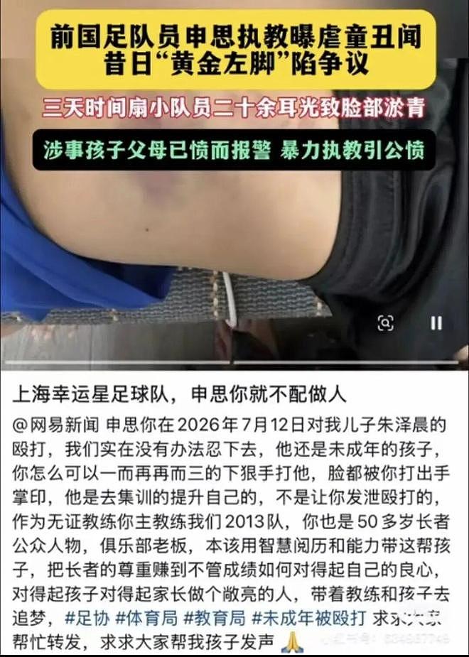 终身禁足的申思,为什么能站在青训场上扇孩子的脸 - 2