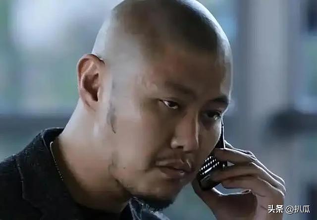 41岁赵荀现状:骨盆用3颗钉子挂在腰上,“特种兵爆改成美娇娘” - 22