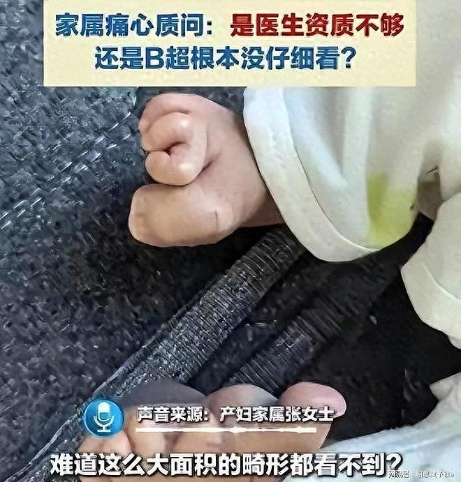 顺产全家盼来哭声，抱出产房却崩溃，8次彩超为何漏掉一双变形脚（组图） - 1