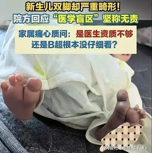 顺产全家盼来哭声，抱出产房却崩溃，8次彩超为何漏掉一双变形脚（组图） - 2