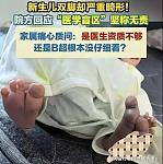 顺产全家盼来哭声，抱出产房却崩溃，8次彩超为何漏掉一双变形脚（组图）
