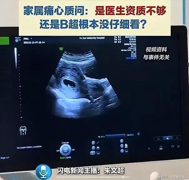顺产全家盼来哭声，抱出产房却崩溃，8次彩超为何漏掉一双变形脚（组图） - 4