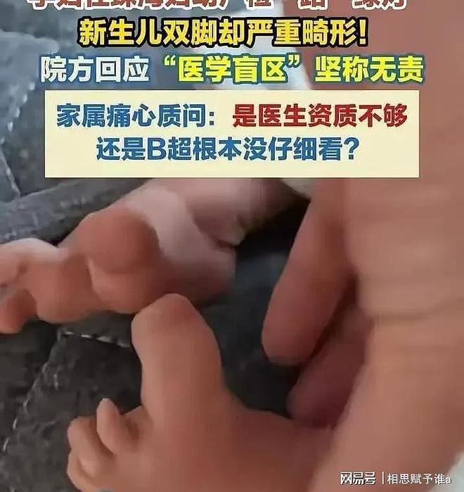 顺产全家盼来哭声，抱出产房却崩溃，8次彩超为何漏掉一双变形脚（组图） - 6