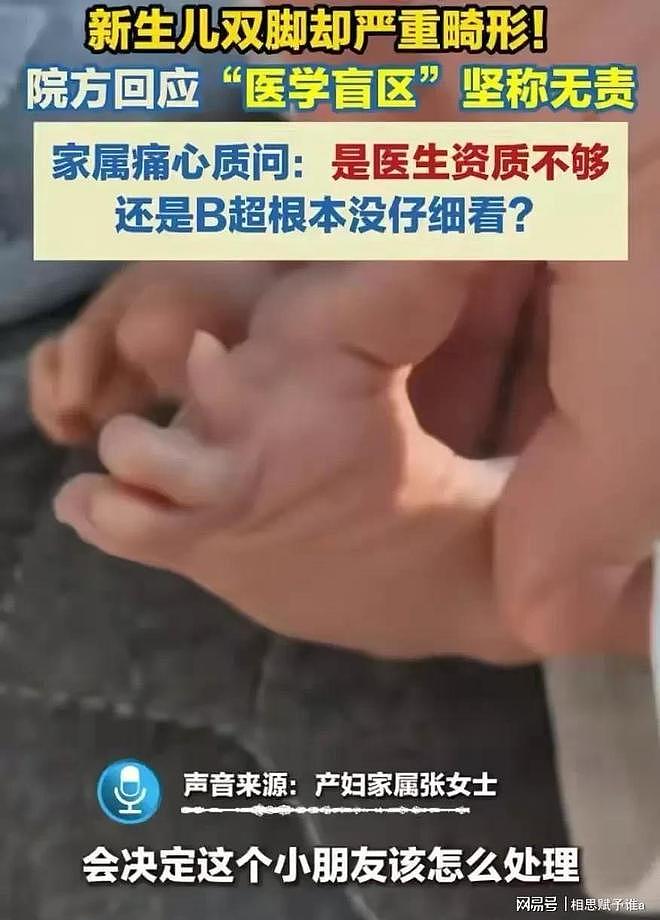 顺产全家盼来哭声，抱出产房却崩溃，8次彩超为何漏掉一双变形脚（组图） - 7