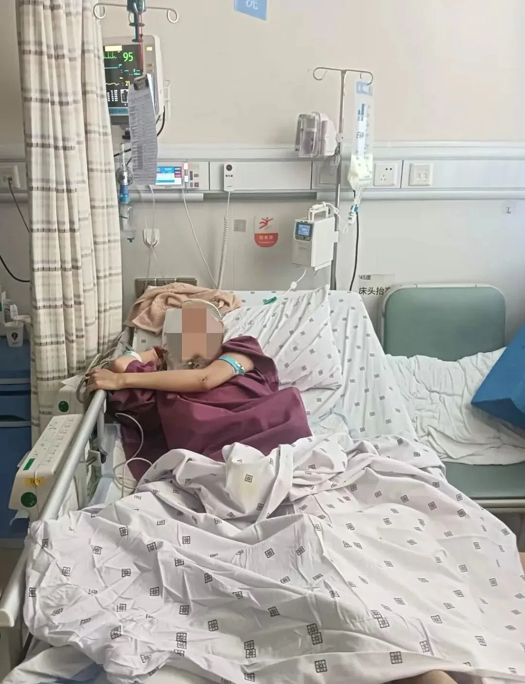 20岁女孩从18楼坠落奇迹生还，家人还原事发细节（组图） - 2