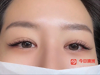  Eyelash Extension