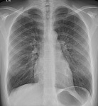  Radiography Assistant Position