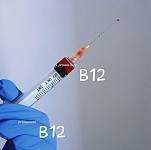  b12 持证上门护理