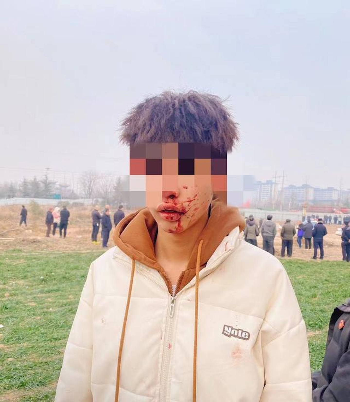 陕西强拆养猪场，6村民遭长棍钢管围殴，官方发通报“辟谣”后删文（视频/组图） - 3