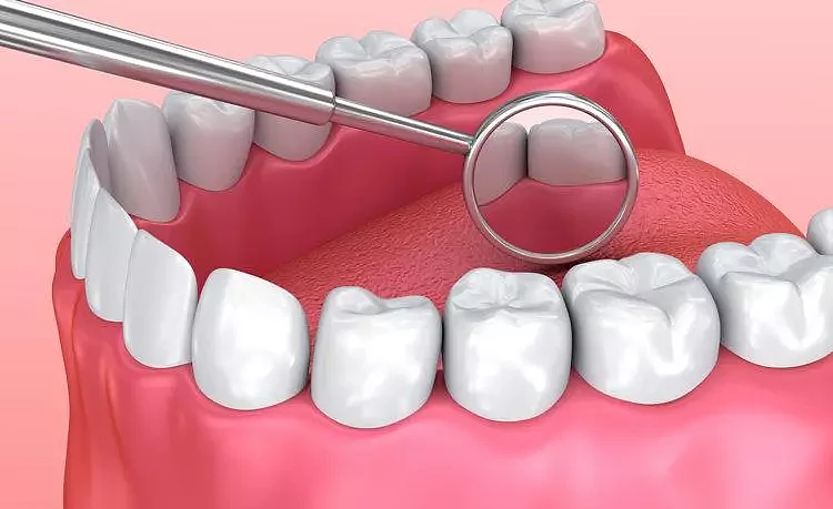【养生】掉牙和寿命有关？60岁之后，牙齿剩多少颗才正常？看看您达标了吗（组图） - 2