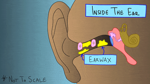 长期“掏耳朵”导致患癌，这个习惯你可能也有（组图） - 2