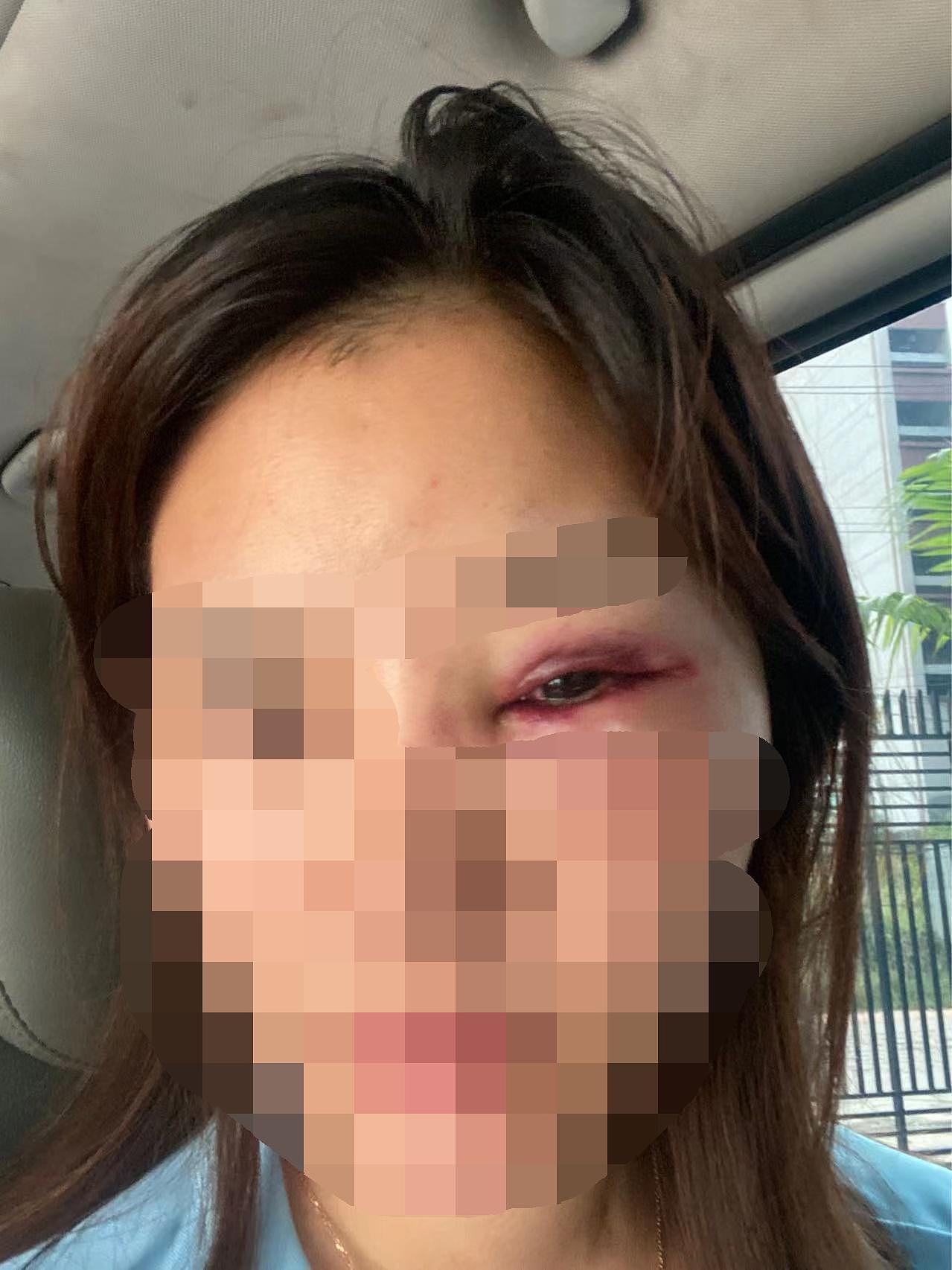 中国女子柬埔寨遭老乡性侵殴打，装顺从逃出报警，给警察小费男子才被捕（组图） - 1