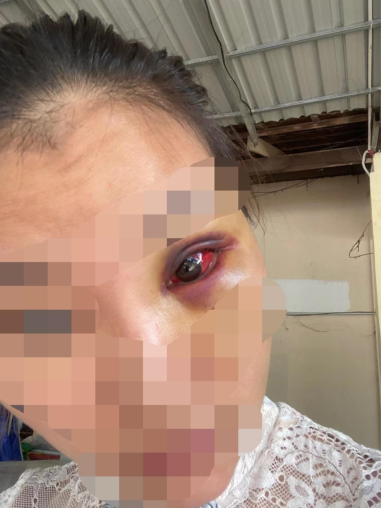 中国女子柬埔寨遭老乡性侵殴打，装顺从逃出报警，给警察小费男子才被捕（组图） - 9