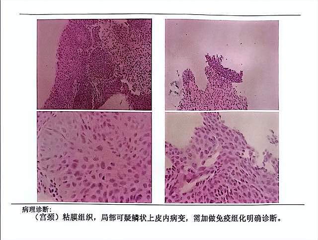 24岁歌手冲上热搜，逼前女友从事性工作还家暴，女方晒多张证据（组图） - 10