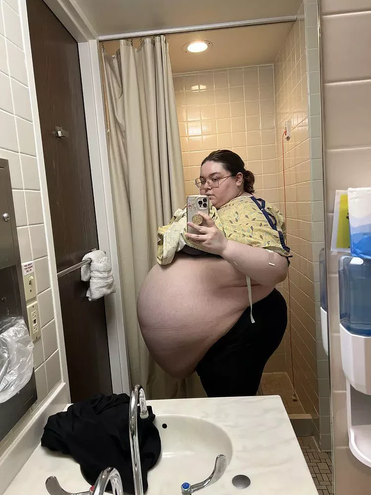 美国女子长了94斤肿块，自嘲像怀了十个娃，发现却不治疗惹争议（组图） - 4