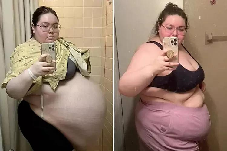 美国女子长了94斤肿块，自嘲像怀了十个娃，发现却不治疗惹争议（组图） - 1