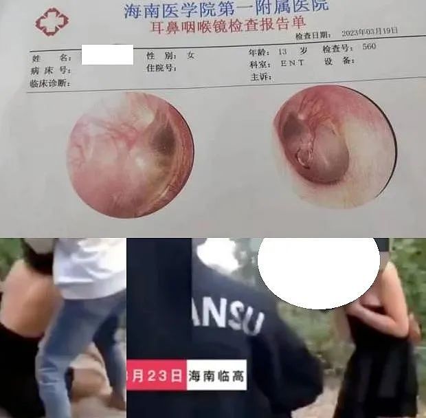 海南13岁女孩被围殴：耳膜穿孔、打到眼瞎！央媒介入调查...（视频/组图） - 2