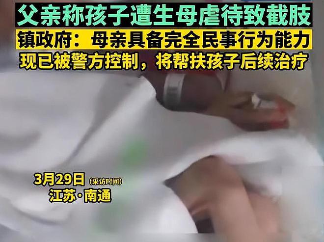 禽兽不如！江苏虐童案，五岁男孩被亲生母亲虐待致截肢，头部脑震荡，下手狠毒（视频/组图） - 1