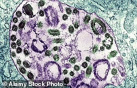 CDC发警告：警惕这种致命病毒在美爆发，致死率高达50%！症状恐怖 - 3