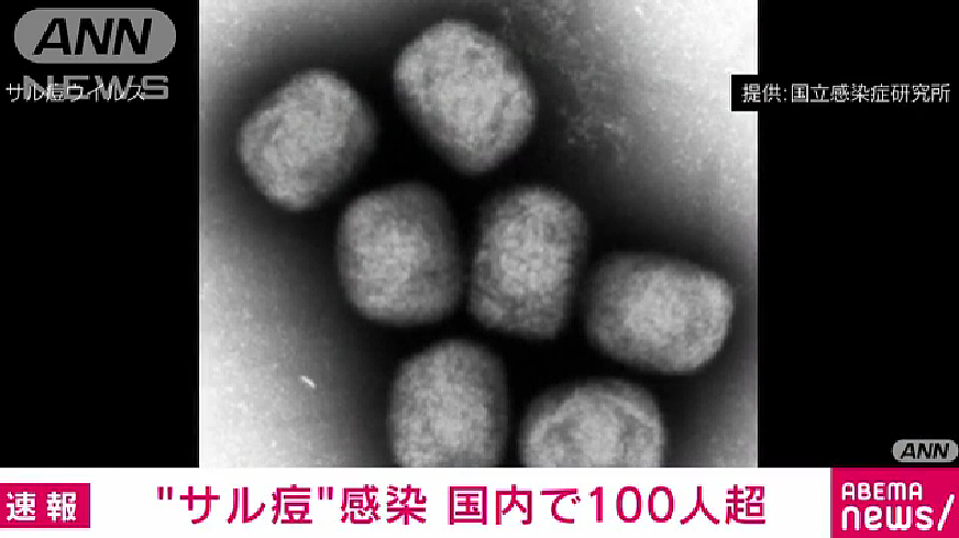 警惕！日本猴痘感染者突然增加，猴痘病毒感染人数超86000，发疹或有水泡要及时就医（组图） - 1