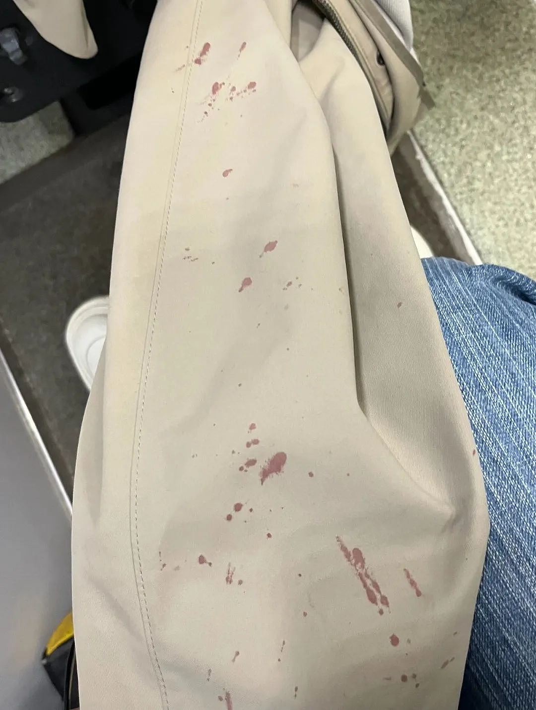 中国留学生伦敦地铁遭非裔重拳袭击： “我满脸鲜血“！ 行凶者竟被保释？（组图） - 2