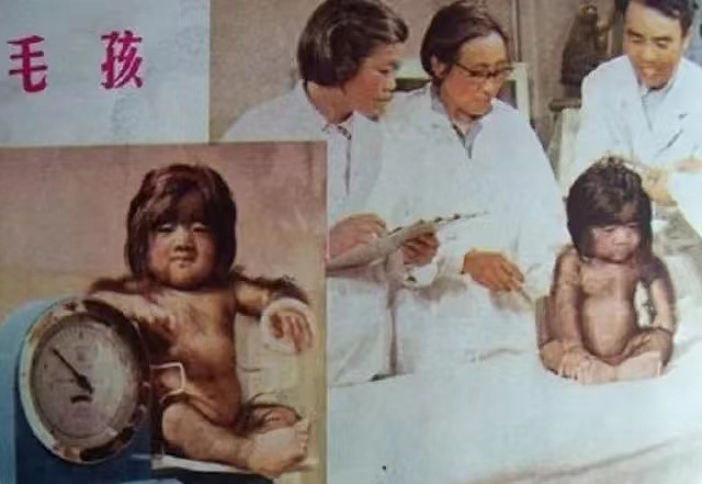 中国第一毛孩，出生就被研究，“一身毛”爆火全球，长大后怎样了（组图） - 6