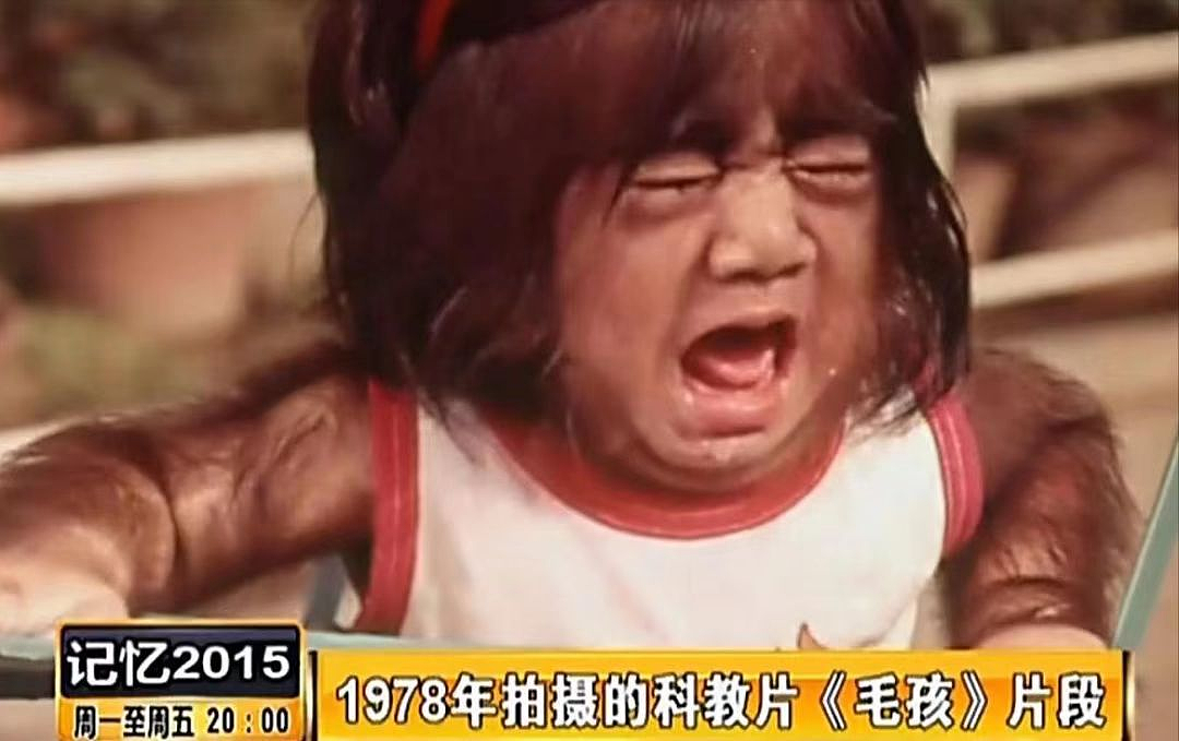 中国第一毛孩，出生就被研究，“一身毛”爆火全球，长大后怎样了（组图） - 7