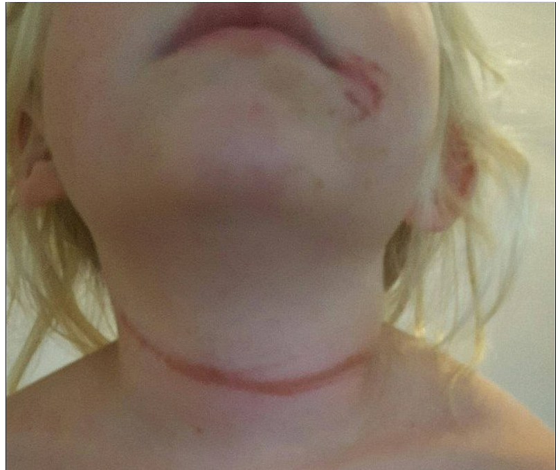超恐怖！澳洲4岁女童外出，一只脚竟突然被“生吞”，妈妈们千万当心了（组图） - 26