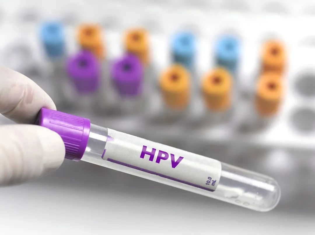 杭州2岁男童体内长出“菜花”，确诊感染HPV！妈妈一句话揪出根源（组图） - 2