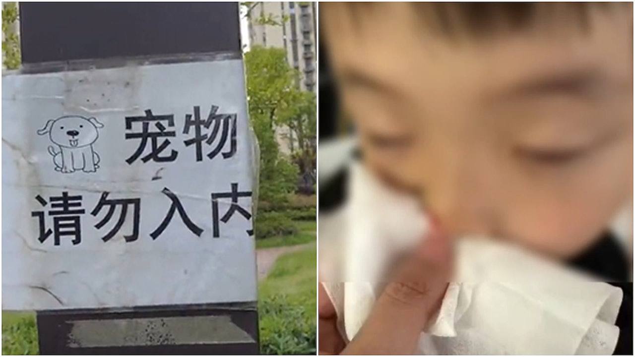 一句话惹祸，上海6岁男童批评邻居遛狗不拴绳，竟遭打至脑震荡（组图） - 1
