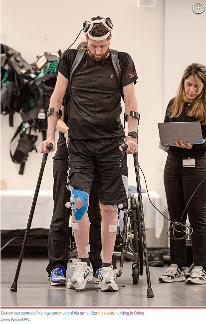 马斯克的脑机接口技术成真！瘫痪12年，他现在站起来走路了（组图） - 8
