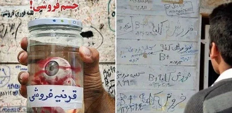 心酸的一幕！为了不饿死，伊朗人正在卖掉睾丸！（组图） - 13