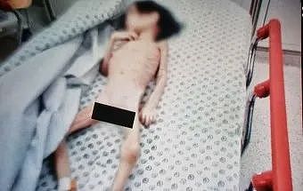 体重仅7kg！5岁女童惨遭虐待成活木乃伊，母亲被逼迫性交易2400多次（组图） - 3